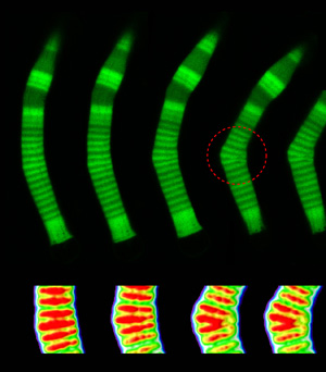 Physicist Finds Clues About Genetic Blindness